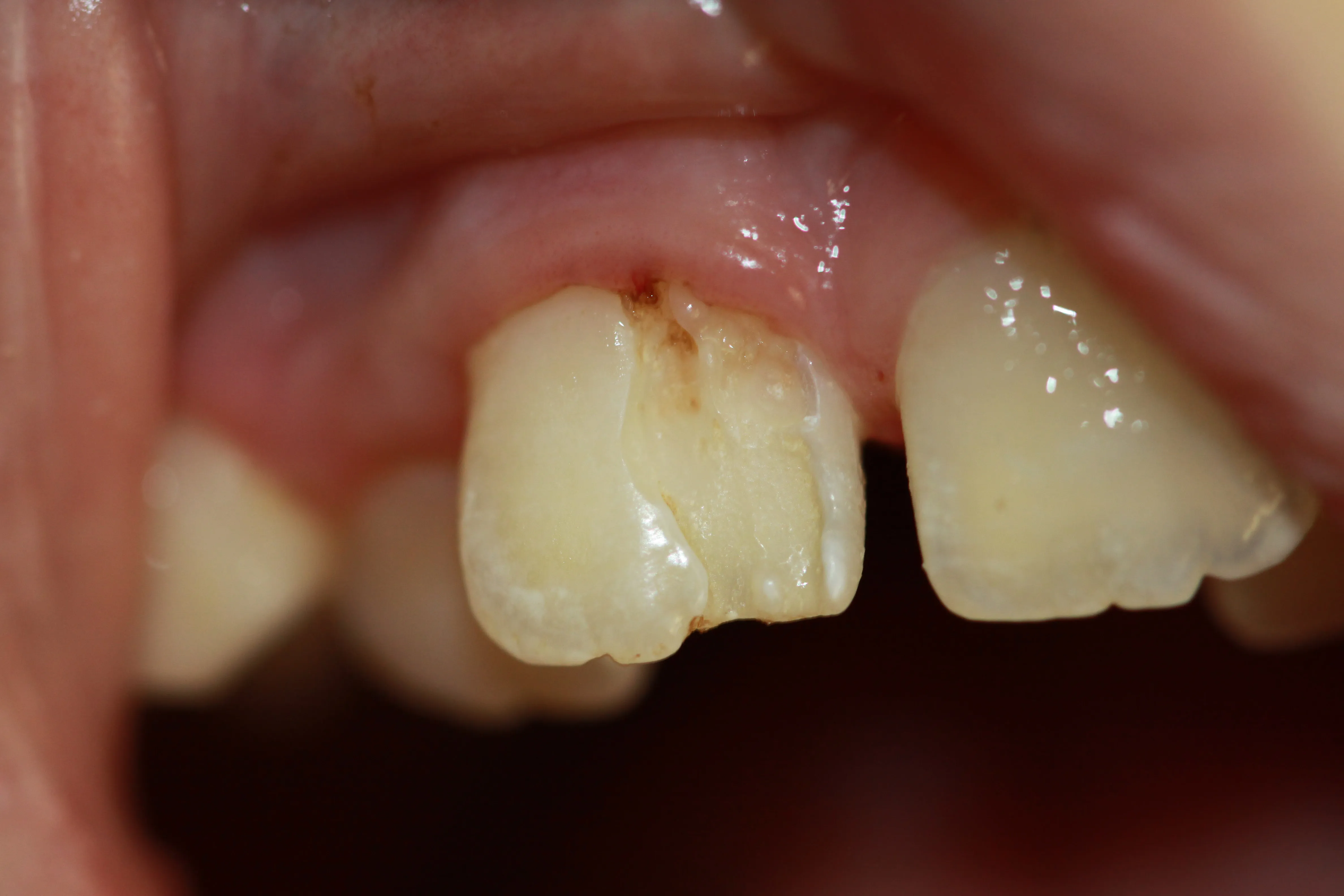 Стоматологічний журнал dental magazine 1