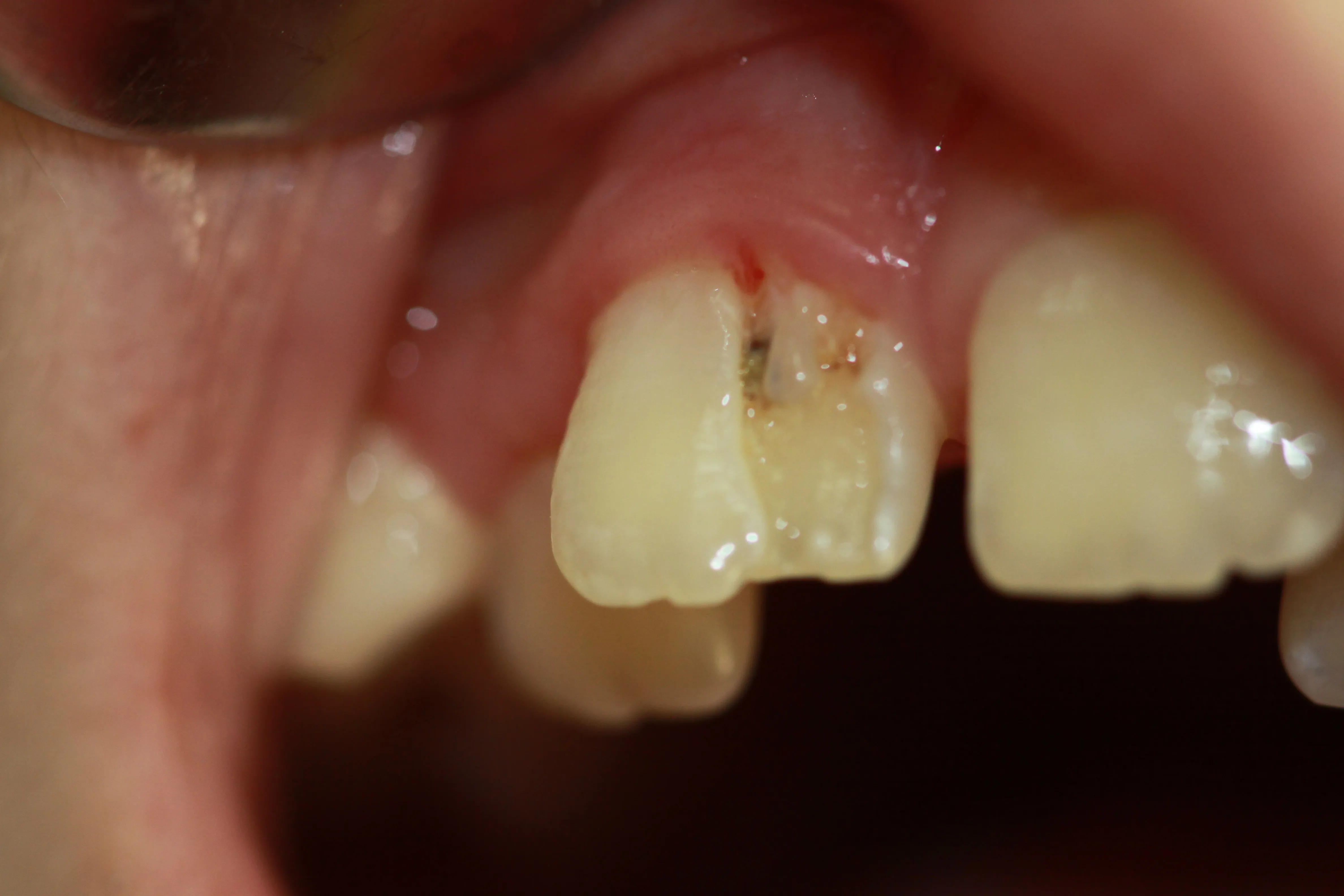 Стоматологічний журнал dental magazine 1
