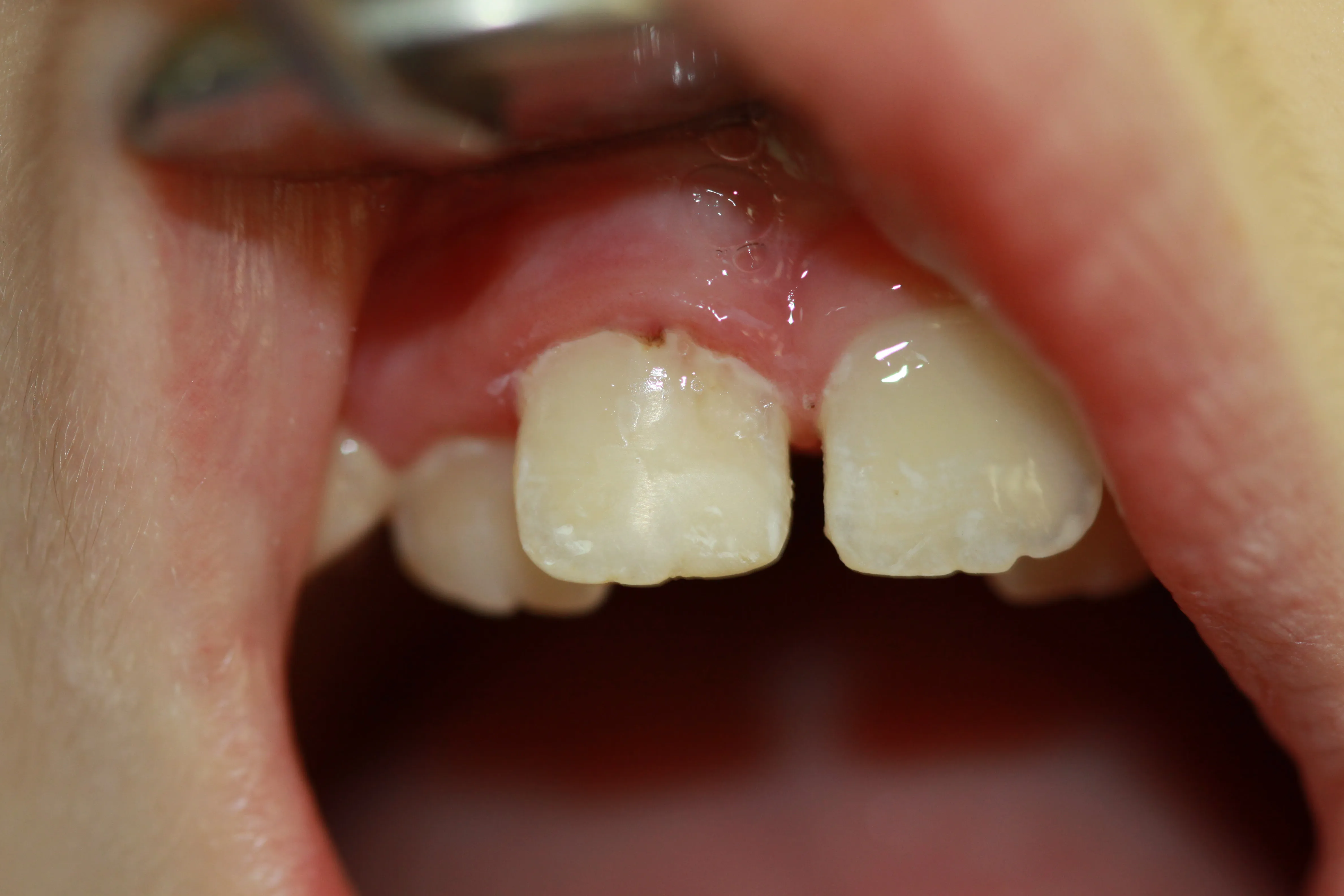 Стоматологічний журнал dental magazine 1