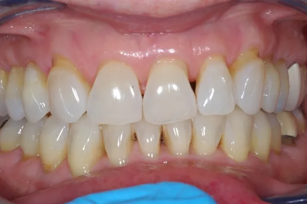 Dentistry № 1 Golicyno, proteză oră implantare