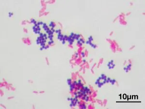 Багрилни свойства - способността на микроорганизмите оцветени