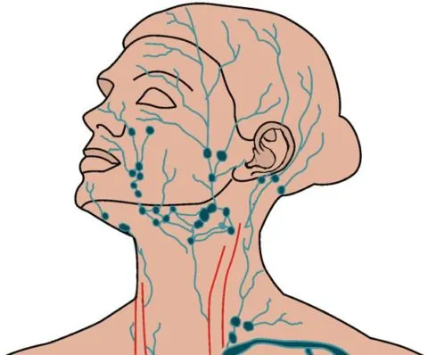 limfatici submandibular mărirea ganglionilor cauze si tratament