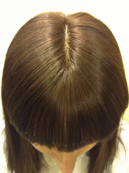възстановяване на косата в центъра на косата подмяна гама