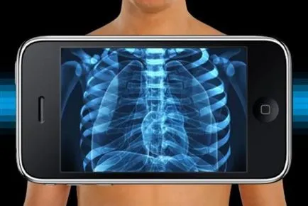 X-ray scanner android, szkennelés minden egy sorban!