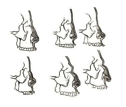Зависимостта на формата на носа от носните кости и хрущяли - структурни образувания човек - лицето на човека