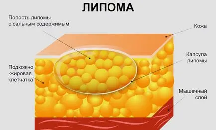 Вън на лицевата страна на структурите за предотвратяване и техните решения