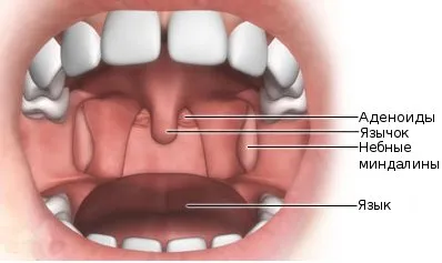 Adenoid vegetáció tünetek, kezelés, mértékét, a megelőzés