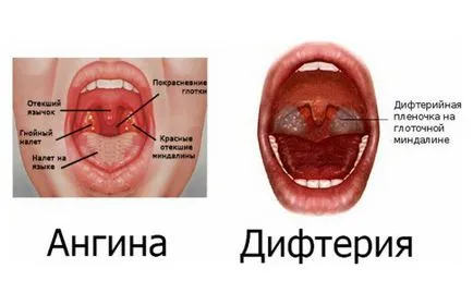 Durere în gât cu o singură mână cauzează o durere în gât pe dreapta sau pe stânga