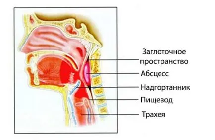 Durere în gât cu o singură mână cauzează o durere în gât pe dreapta sau pe stânga