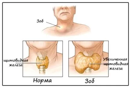 Какво означава щитовидната ултразвук