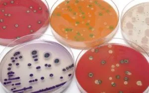 Чувствителността на бактериите към антибиотици и бактериофаги