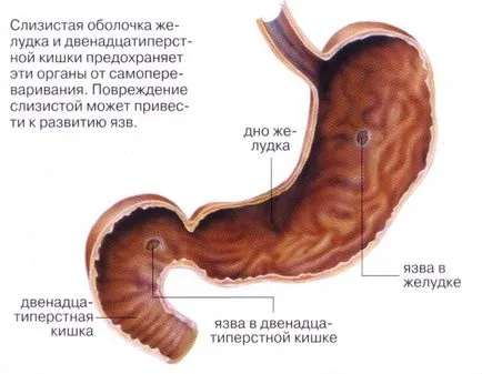 Diet menü gyomorhurut gyomor egy hétre, és elfogadható az élelmiszer