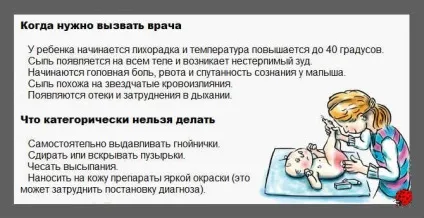 Висип на спині у дитини
