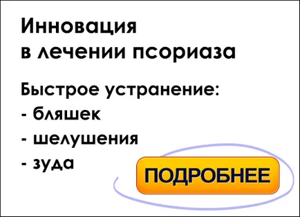 Як розпізнати псоріаз - перші ознаки псоріазу