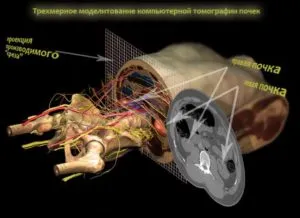 Adrenal tomografie computerizata (CT) - cum este efectuată, de pregătire