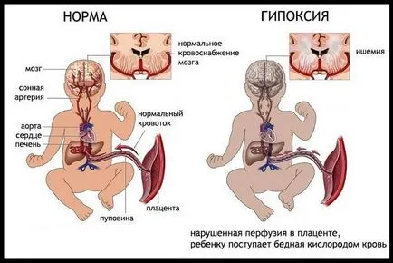 Пушачи по време на бременност ефекти, отколкото опасно, заплашително, каква е причината за едно дете