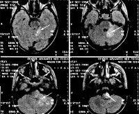 RMN în neurologie - prețurile la Moscova găsite prețurile în 1600