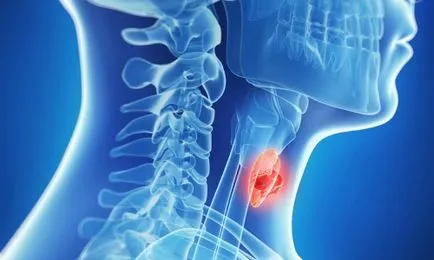 Щитовидната класификация и лечение на тумор