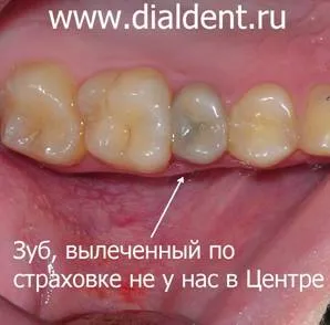 За стоматологична застраховка