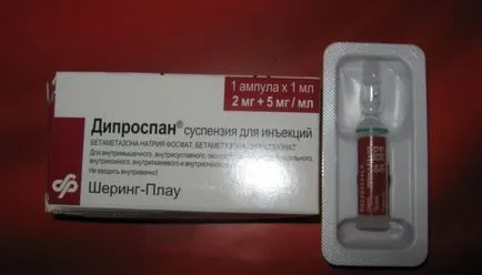 Osteochondrosis tünetek, gyógyszer, injekció