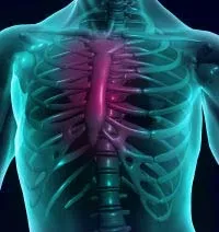 Фрактура лечебни ефекти гръдната кост, симптоми