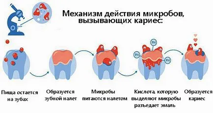 Nutriție și Cariile - alimente utile și dăunătoare, dieta cu cariile - portalul stomatologic