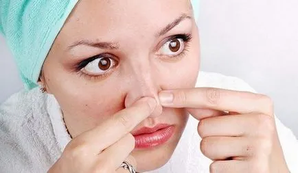 Peeling szóda arc problémás bőr, sóval, peroxid, vélemények