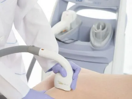 Procedura cryolipolysis privind indicațiile aparatului zeltik medic pentru procedura, comentarii, fotografii înainte și după