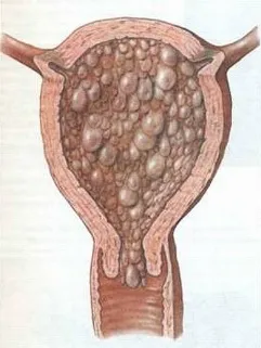 cauze sarcina molara, simptome, tratament