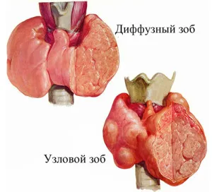 Descifrarea caracteristici cu ultrasunete tiroidian a procedurilor și standardelor de performanță