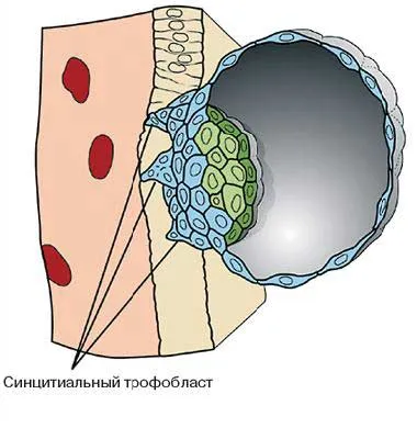 cauze sarcina molara, simptome, tratament