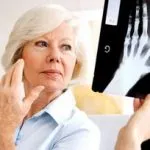 A rheumatoid arthritis tünetek és a kezelés