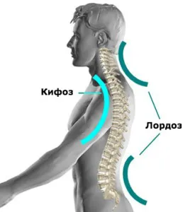 Nyaki lordosis lapított, hogy mit jelent, tünetek, kezelés