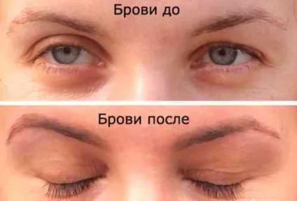 Як відростити брови - густі, в домашніх умовах, швидко (швидко) Як відростити брови - густі, в домашніх умовах, швидко