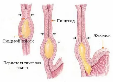 Nyelőcső-görcs tünetek és a kezelés, hogyan kell eltávolítani