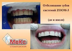 Clinica Stomtologicheskaya max Belgorod