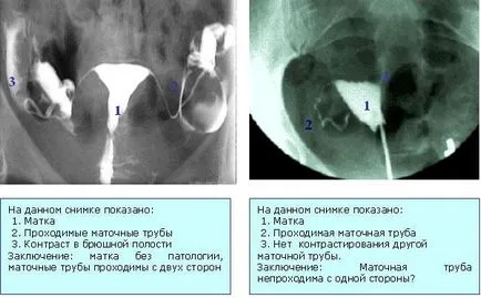 Bend цервикална патология, която е, причинява лечението