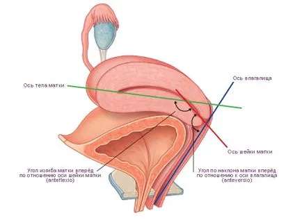 Bend patologia de col uterin, care este, cauze, tratament