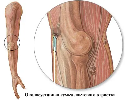 Cauze bursită, simptome, tratament