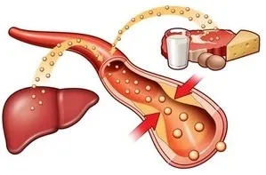 Опасностите от висок холестерол в кръвта на здравословни рецепти