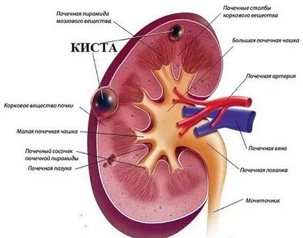 Mint kezelni a vese fáj, ha a tünetek kezelésére és népi jogorvoslati