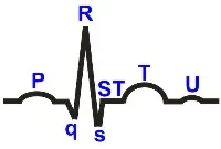 Ceea ce atrage ECG intervale de segmente de dinți