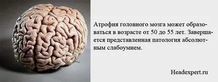 Какво е атрофия на мозъка