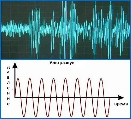 Какво е ултразвук и как тя е полезна