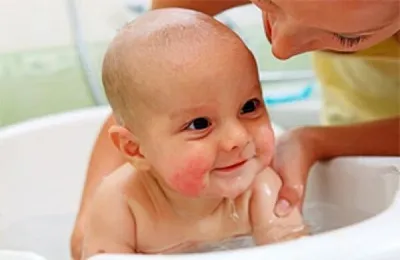 Dermatitis egy csecsemő kezelésére, a tünetek és az okok