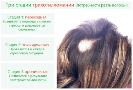 Трихотилломания - причини і лікування прагнення рвати волосся у дітей і дорослих (лікування) Трихотилломания - причини і лікування прагнення рвати волосся у дітей і дорослих
