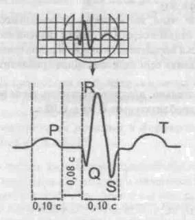 Electrocardiogram - EKG források fogak, időközök és szegmensek EKG