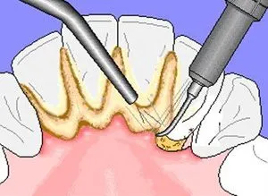 Cosmetic Stomatologie - MEGADENT - Krasnoyarsk stomatologie, centru stomatologic