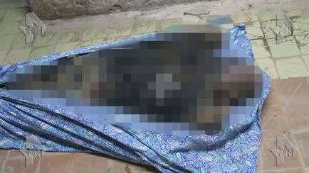 Fényképek (18) 3 hónappal az orvosok nem vették észre a beteg holttest fekszik a kórházban Kirzhach