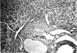 Хистологичните промени в черния дроб - studopediya